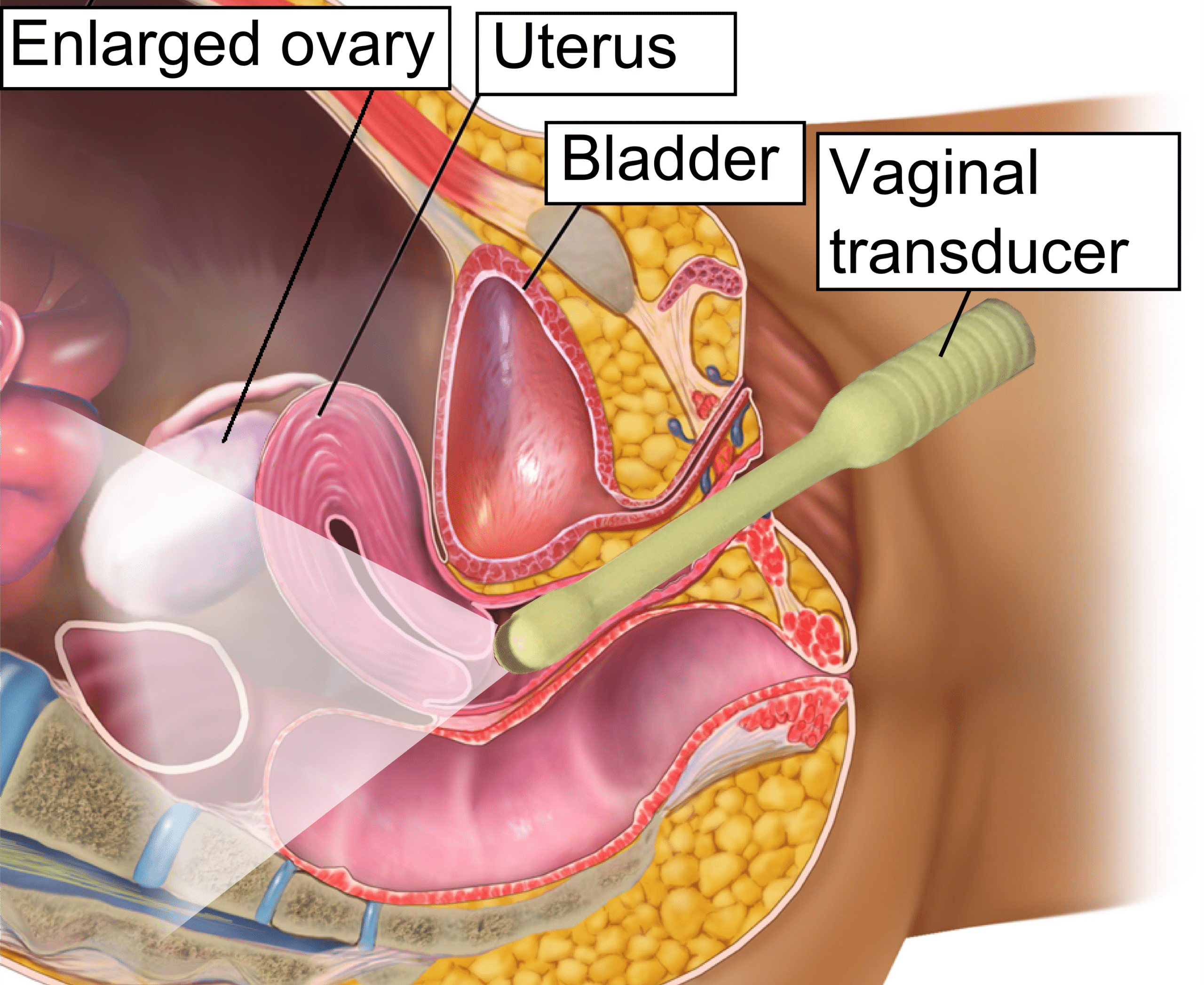 Vaginal